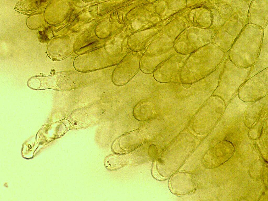 Pseudaleuria fibrillosa 2020 09 11 poils marginaux 4