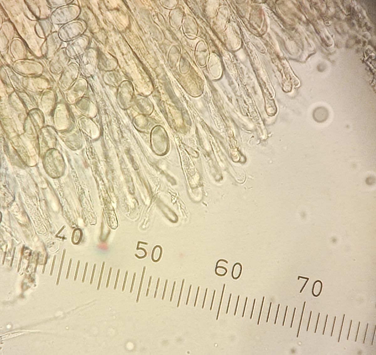 2 A. babingtonii asques et paraphyses émergeantes