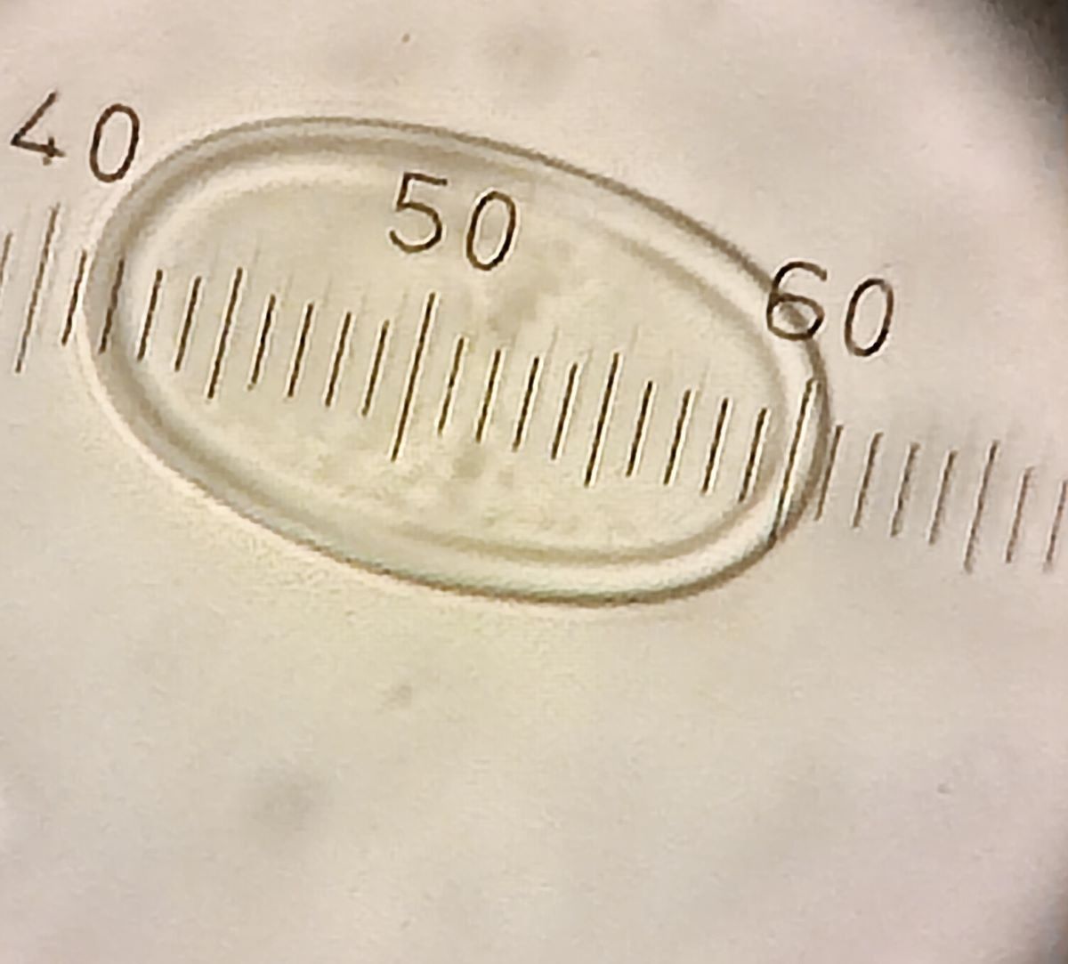 5 A. babingtonii spore L = 19 (20) 21 µ